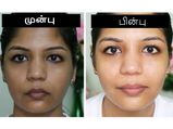 முகம் பொலிவிழந்து கருப்பா அசிங்கமா இருக்கா? இத தினமும் காலையில செய்யுங்க...