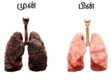 சிகரெட்டால் கருகிப் போன நுரையீரலை சுத்தம் செய்ய உதவும் அற்புத டானிக்!