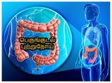 இந்த உணவுகள் குடல் புற்றுநோய் வராமல் தடுப்பதோடு புற்றுநோய் செல்களை எதிர்த்து போராடுமாம் தெரியுமா? 