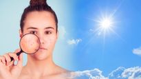 Summer Skin Care Tips: கோடையில் முகப்பரு பிரச்சனைக்கு முற்றுப்புள்ளி வெக்கணுமா? இதோ சில டிப்ஸ்...