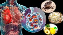 World Tuberculosis Day 2023: 'டிபி'யை உண்டாக்கும் பாக்டீரியாக்களை அழிக்கும் சில இயற்கை வழிகள்!