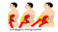 குண்டா இருந்தா கொலஸ்ட்ரால் வருமா? ஒல்லியா இருந்தா வராதா? ஆய்வு சொல்லும் அதிர்ச்சி உண்மை என்ன தெரியுமா?