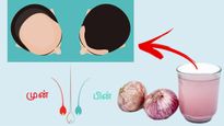 வழுக்கையிலும் தலைமுடி வளரணுமா? அப்ப வெங்காயத்தை இந்த மாதிரி தொடர்ந்து 7 நாள் யூஸ் பண்ணுங்க..