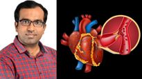 இதய இரத்தக்குழாயில் அடைப்பு இருப்பதை ஆரம்பத்திலேயே அறிவது எப்படி? - டாக்டரின் முக்கிய அட்வைஸ்..