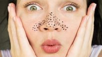 Skin Care Tips In Tamil: உங்க முகத்தை அசிங்கமாக்கும் கரும்புள்ளிகளை நீக்க...இந்த 5 ஃபேஸ் பேக்கை யூஸ் பண்ணுங்க!