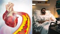 'இந்த' அறிகுறிகள் உங்களுக்கு இருக்கா? அப்ப உயிருக்கே ஆபத்தை ஏற்படுத்தும் அதிக கொலஸ்ட்ரால் உடலில் இருக்காம்! 