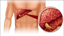 அதிகமாக உடற்பயிற்சி செய்தால் கல்லீரல் பாதிக்கப்படுமாம்- ஆய்வில் அதிர்ச்சி தகவல்