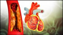 Heart Blockage: இதயத்தில் அடைப்பு ஏற்படக்கூடாதா? அப்ப இந்த விதைகளை தினமும் ஒரு கையளவு சாப்பிடுங்க..