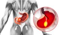 Stomach Cancer: மௌத் வாஷ் வெச்சே வயிற்று புற்றுநோயை ஆரம்பத்திலேயே அறியலாம் தெரியுமா? எப்படின்னு பாருங்க..