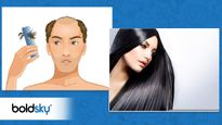 Hair Fall Tips: உங்க முடி ஓவரா கொட்டுதா? அப்ப இந்த பொருட்களை தினமும் சாப்பிடுங்க... டக்குனு நின்னுரும்...!