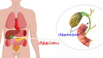உங்க பித்தப்பையை அகற்ற வேண்டிய நேரம் வந்துவிட்டது என்பதை உணர்த்தும் எச்சரிக்கை அறிகுறிகள்!