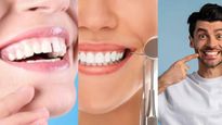 உங்கள் பற்களுக்கு இடையே இடைவெளி இருக்கிறதா? அதை தடுக்க இந்த டிப்ஸை ட்ரை பண்ணுங்கள்..!