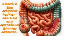 உங்களிடம் இந்த 3 அறிகுறிகள் தெரியுதா? அப்ப உங்க குடல் ஆரோக்கியமா இல்லன்னு அர்த்தமாம்.. நோட் பண்ணுங்க..
