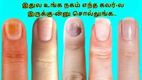 இதுல உங்க நகம் எந்த கலர்-ல இருக்கு-ன்னு சொல்லுங்க.. உங்க உடம்புல என்ன பிரச்சனை-ன்னு சொல்றோம்...