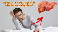 உங்ககிட்ட இந்த 8 அறிகுறியும் தெரியுதா? அப்ப கல்லீரல் ஆபத்துல இருக்குன்னு அர்த்தமாம்.. எச்சரிக்கும் டாக்டர்!