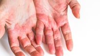 கையில் இந்த மாற்றங்கள் தெரியுதா? அப்ப உடம்புல இந்த நோய் இருக்க வாய்ப்பிருக்கு.. உஷார்..