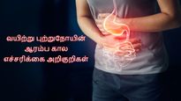 உங்ககிட்ட இந்த 5 அறிகுறிகள் தெரியுதா? அப்ப அசால்ட்டா இருக்காதீங்க.. அது வயிற்று புற்றுநோயா இருக்கலாம்!