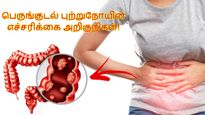 இந்த 5 அறிகுறிகள் தெரியுதா? அப்ப குடல் புற்றுநோய் இருக்கு-ன்னு அர்த்தம்.. எச்சரிக்கும் அமெரிக்க டாக்டர்..