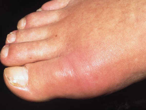 பாதம் மற்றும் கணுக்கால்