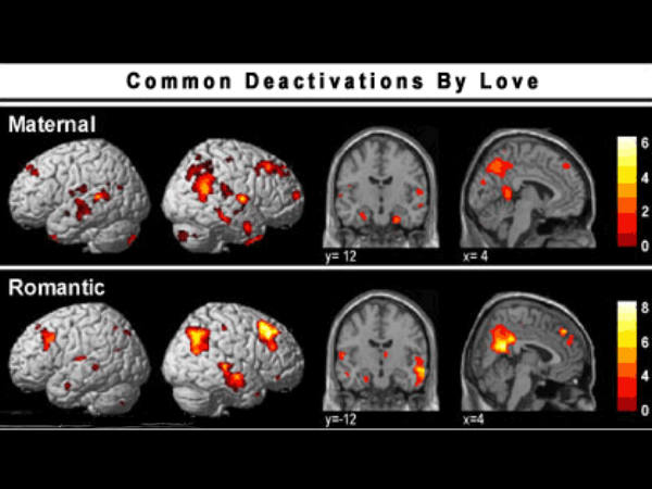 மூளையின் மேப்