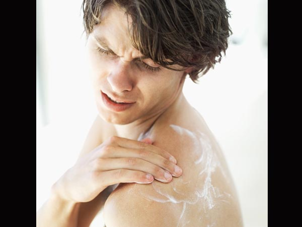 சரும அரிப்பு சரும அரிப்பு