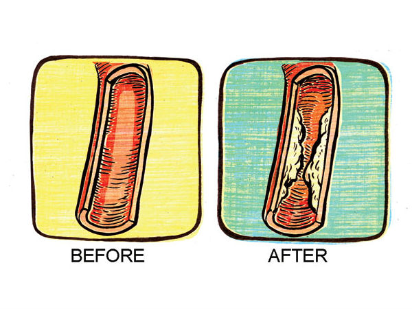 புகைப்பது