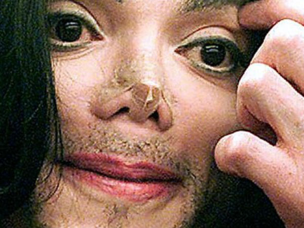 தோல்களின் நிறம் மாறுதல்