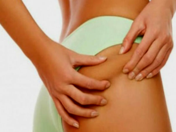 குத கட்டிகள் 