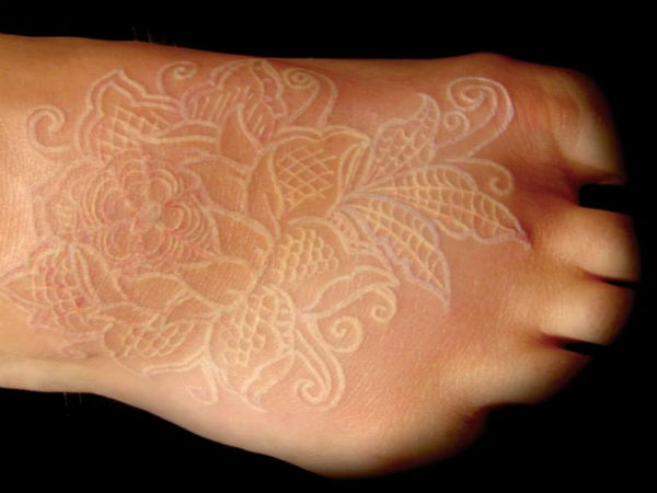 தோலின் நிறம் மாறுதல்