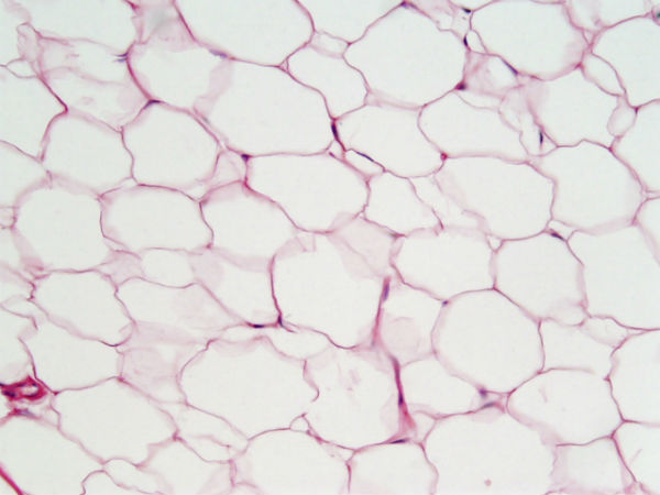 புது திசுக்கள்