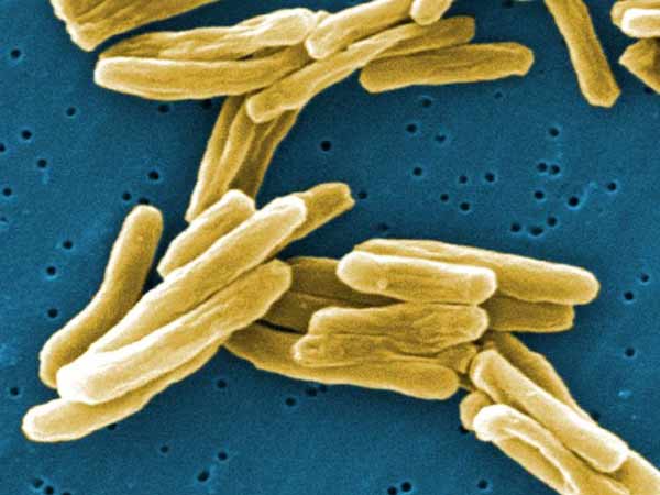 நுண்ணுயிர் கிருமிகளை அழிக்கும் 