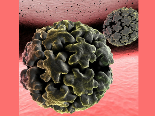 பாப்பிலோமா (HPV - Human Papilloma Virus) 