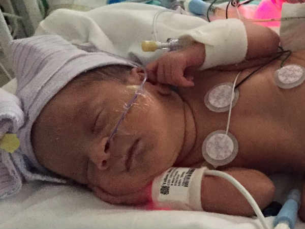 குழந்தைகளுக்கு அறுவை சிகிச்சை 