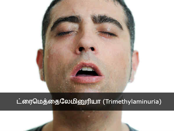 ட்ரைமெத்தைலேமினுரியா (Trimethylaminuria) 