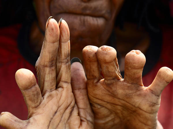 விரல்களை வெட்டுதல் விரல்களை வெட்டுதல்