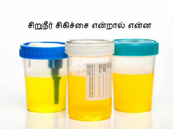 சிறுநீர் சிகிச்சை என்றால் என்ன 