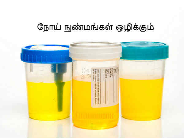 நோய் நுண்மங்கள் ஒழிக்கும் 
