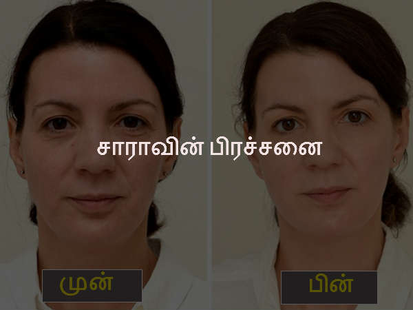 சாராவின் பிரச்சனை