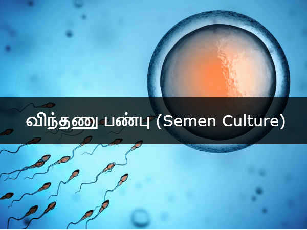 விந்தணு பண்பு (Semen Culture) 