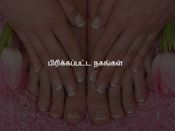 பிரிக்கப்பட்ட நகங்கள் பிரிக்கப்பட்ட நகங்கள்