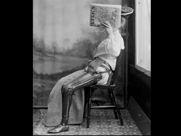 செயற்கை கால்