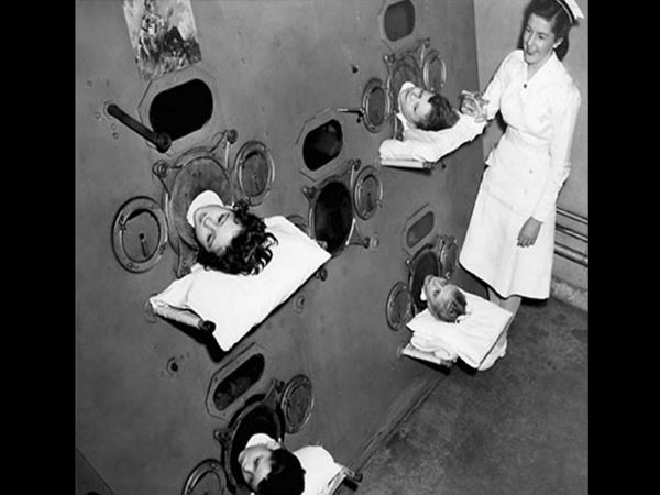 போலயோ மருந்து தரும் முறை