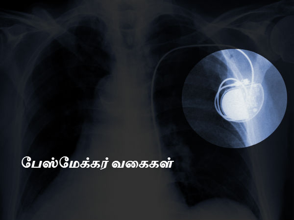 வகைகள்
