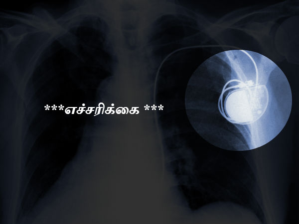 எச்சரிக்கை 