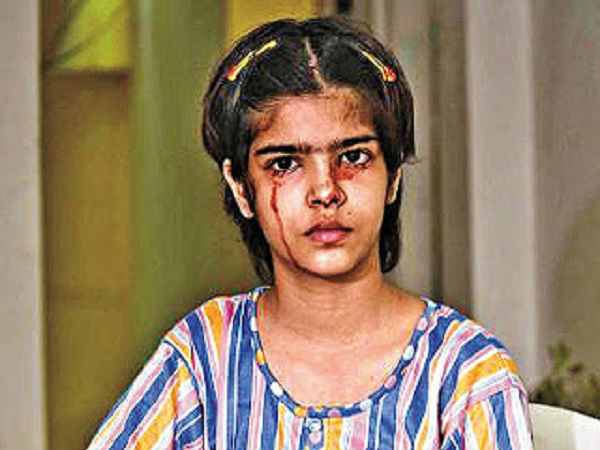 இரத்த கண்ணீர் வடித்த சிறுமி