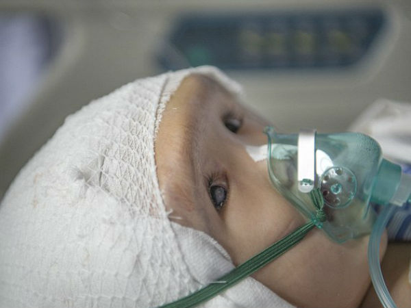 அறுவை சிகிச்சையின் போது 