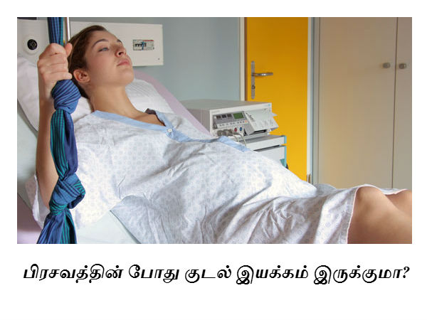 பிரசவத்தின் போது குடல் இயக்கம் இருக்குமா? 
