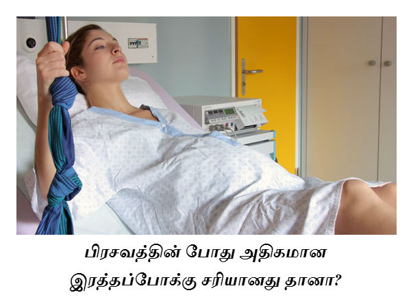 பிரசவத்தின் போது அதிகமான இரத்தப்போக்கு சரியானது தானா? 