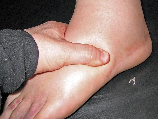 கால்களில் வீக்கம்