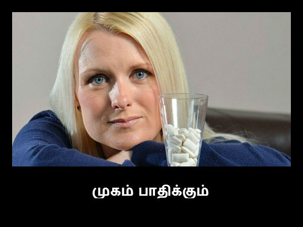 முகம் பாதிக்கும் 